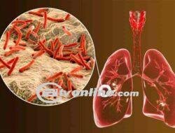 Tingginya Angka Kasus Tuberkulosis di Kota Medan: Dinas Kesehatan Siapkan Gerakan Cepat Tangkap